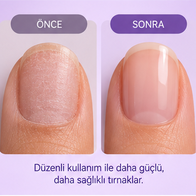 İLVENAILS 3'ü 1 Arada Bakım Kalemi